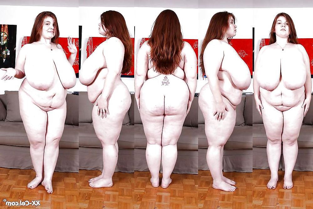 25P Stretch Marks, Scars and Saggy 11