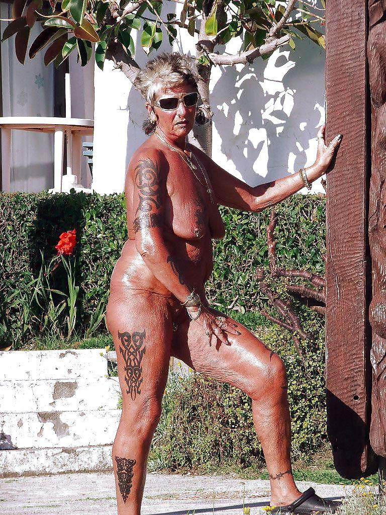 12P Stretch Marks, Scars and Saggy 2