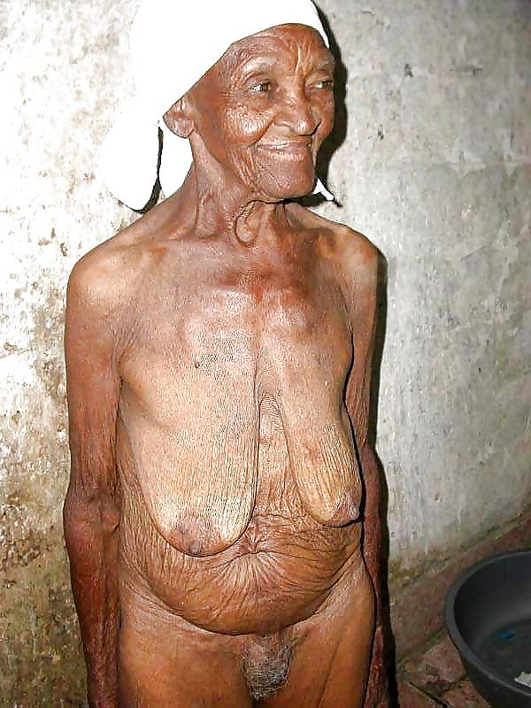 12P Stretch Marks, Scars and Saggy 2