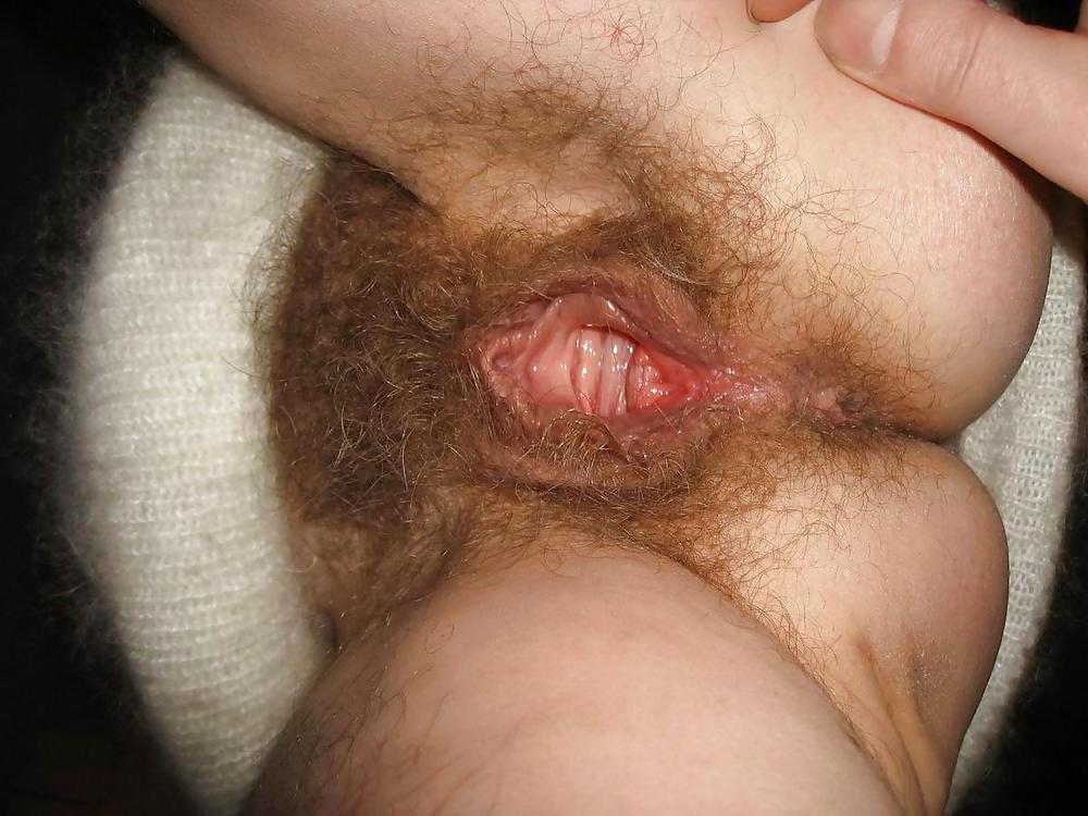 23P Hairy dreams 182