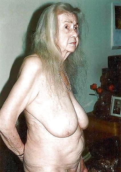 25P Stretch Marks, Scars and Saggy 18