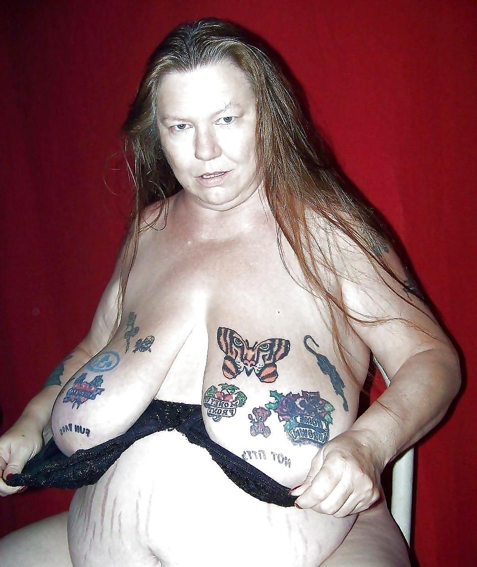 25P Stretch Marks, Scars and Saggy 18