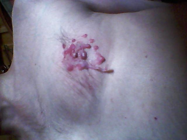16P Wax and fire cire et feu