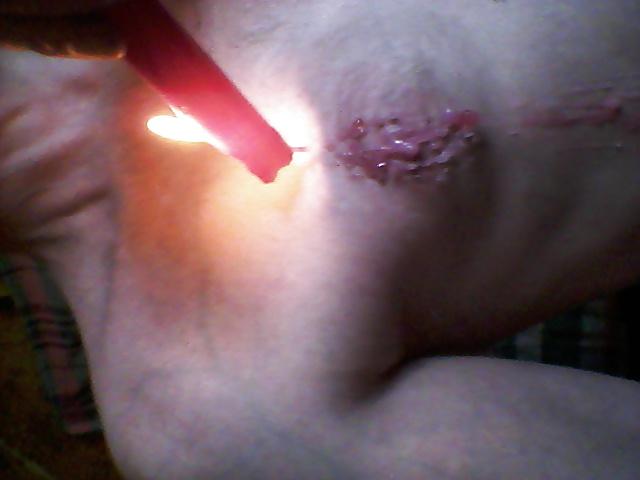16P Wax and fire cire et feu