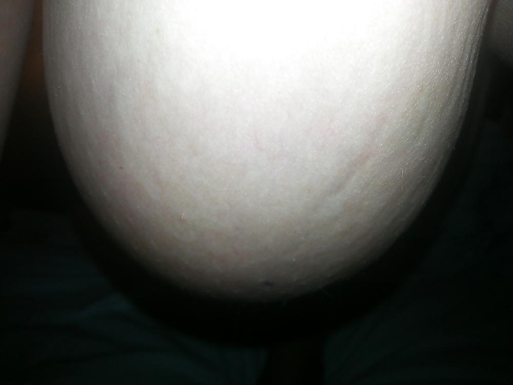 25P Slut Lateshay white saggy floppy 36G tits