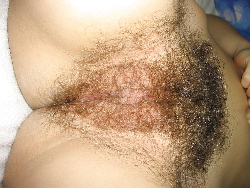 19P Hairy young teen - N. C. 