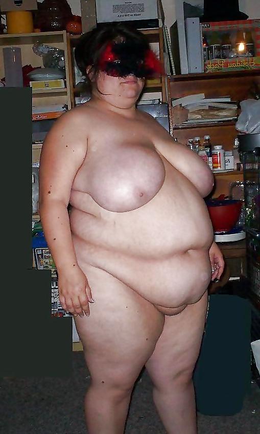 25P Stretch Marks, Scars and Saggy 22