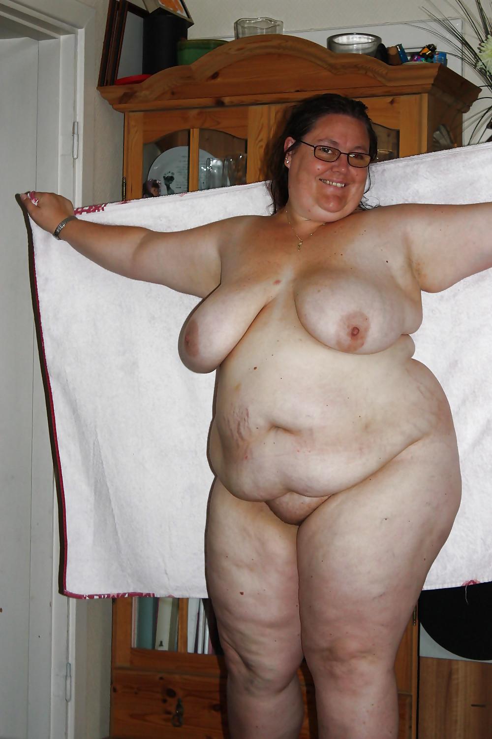 25P Stretch Marks, Scars and Saggy 22