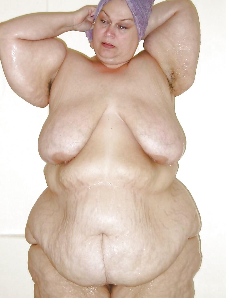 25P Stretch Marks, Scars and Saggy 22