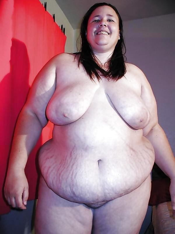 25P Stretch Marks, Scars and Saggy 22
