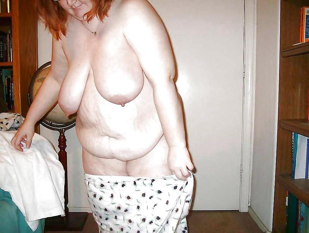 25P Stretch Marks, Scars and Saggy 14