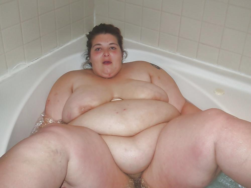 25P Stretch Marks, Scars and Saggy 14