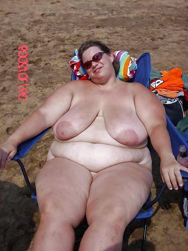 25P Stretch Marks, Scars and Saggy 14
