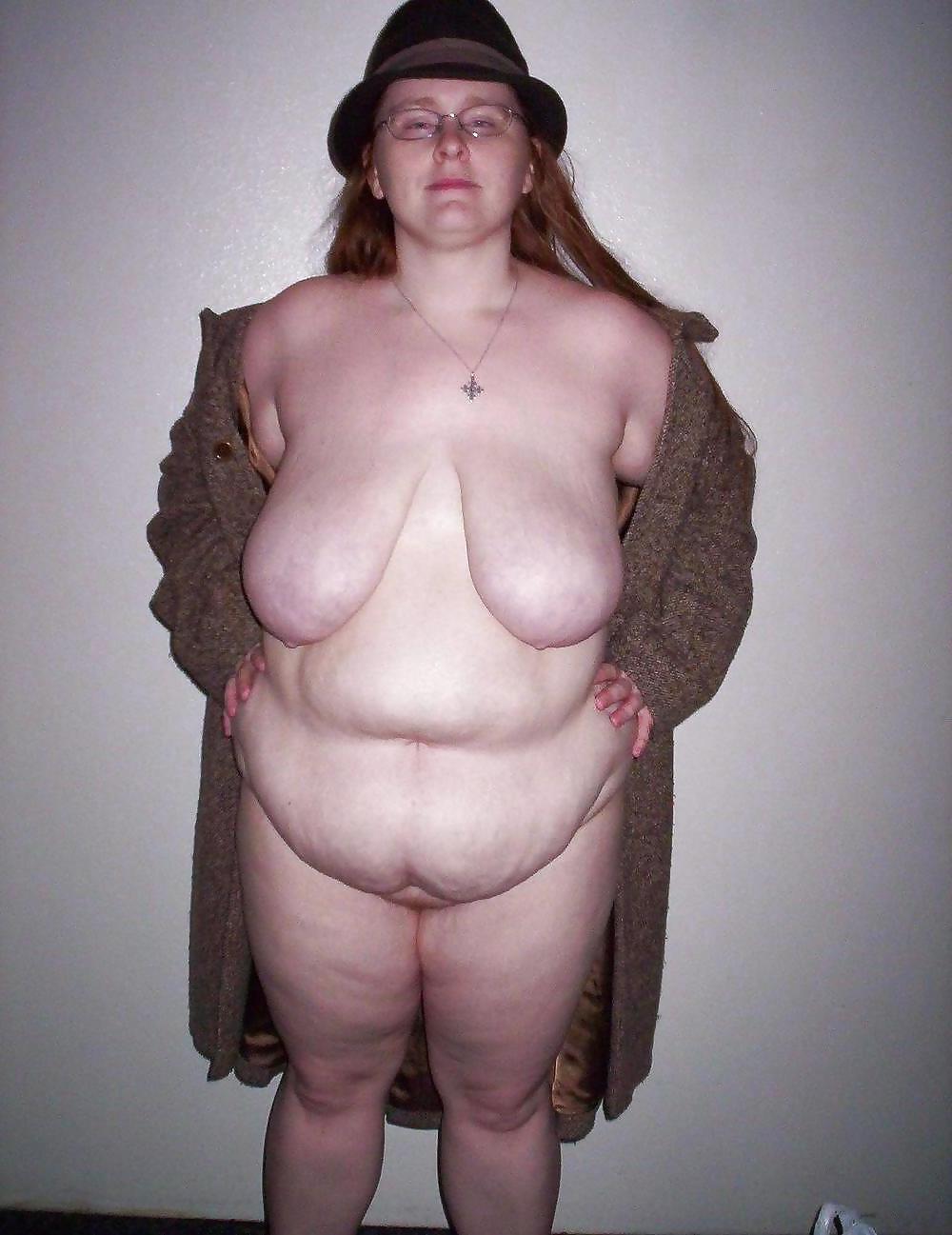 25P Stretch Marks, Scars and Saggy 14
