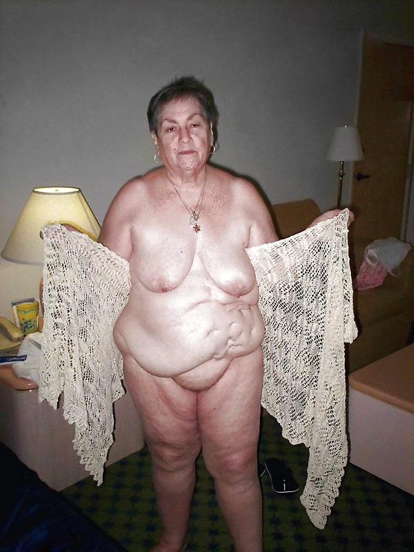 25P Stretch Marks, Scars and Saggy 17