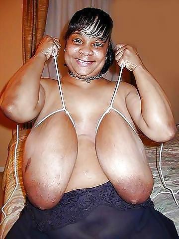 25P Stretch Marks, Scars and Saggy 17