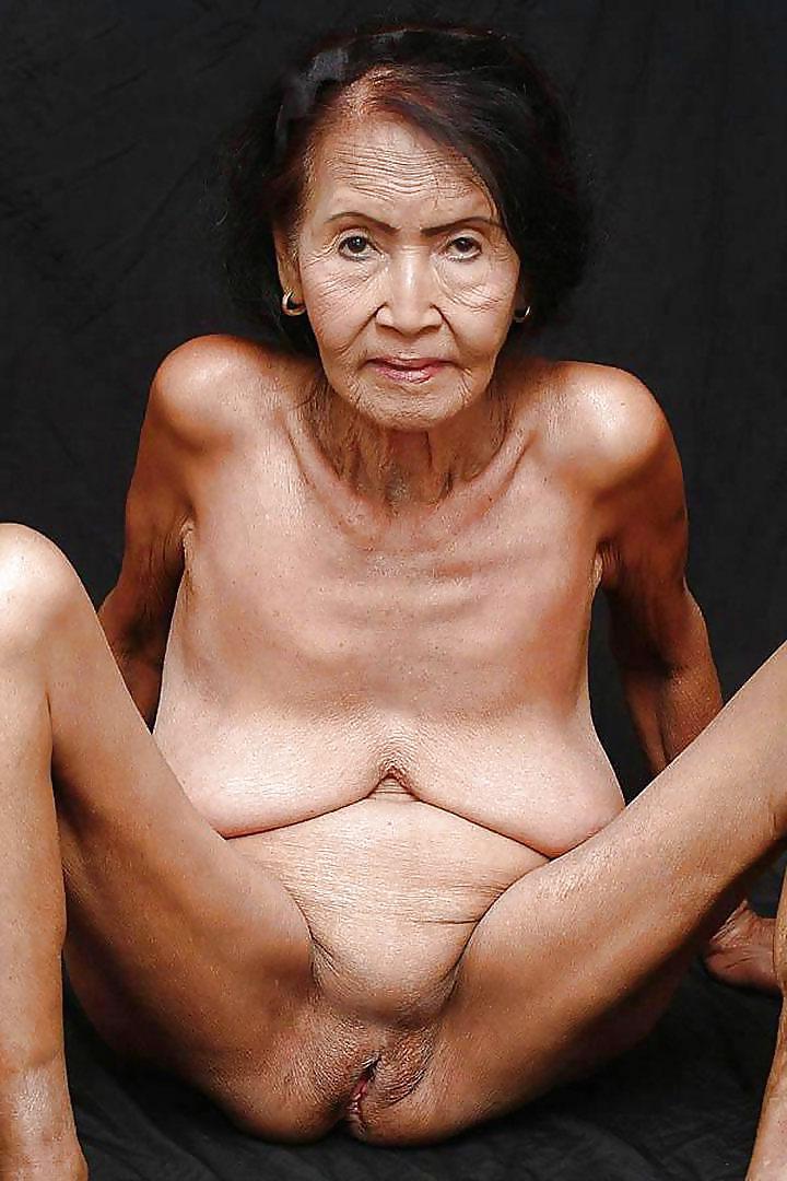 25P Stretch Marks, Scars and Saggy 17