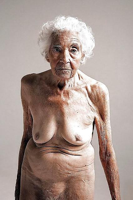 25P Stretch Marks, Scars and Saggy 17