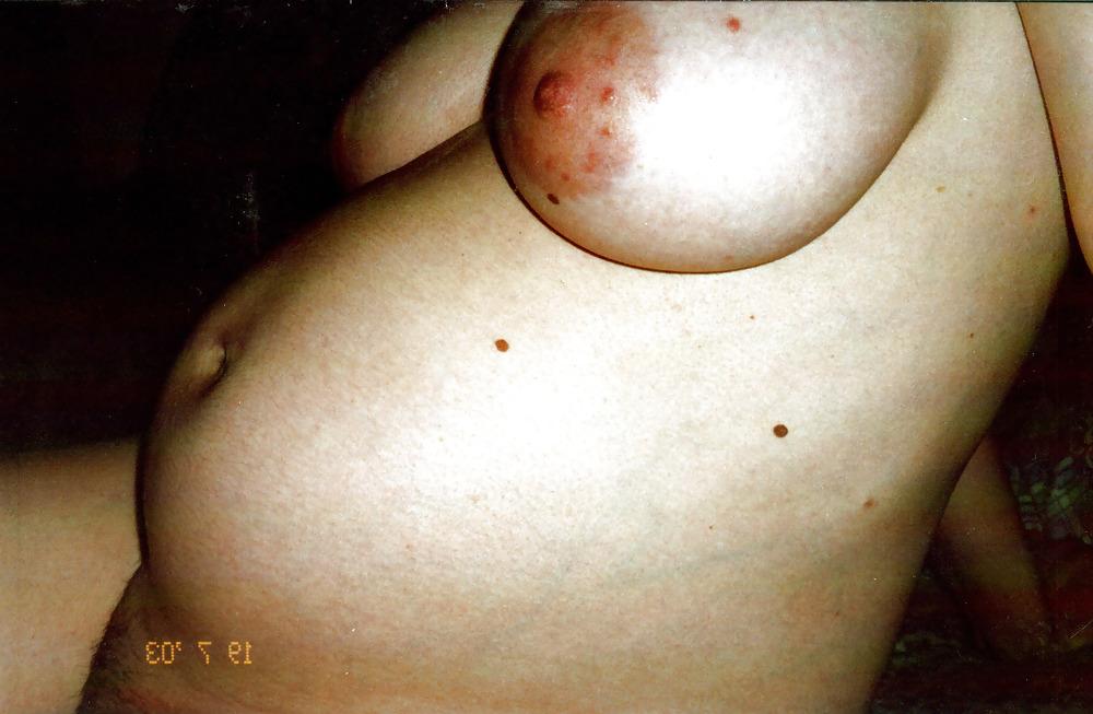 13P Pregnance first time (2003)