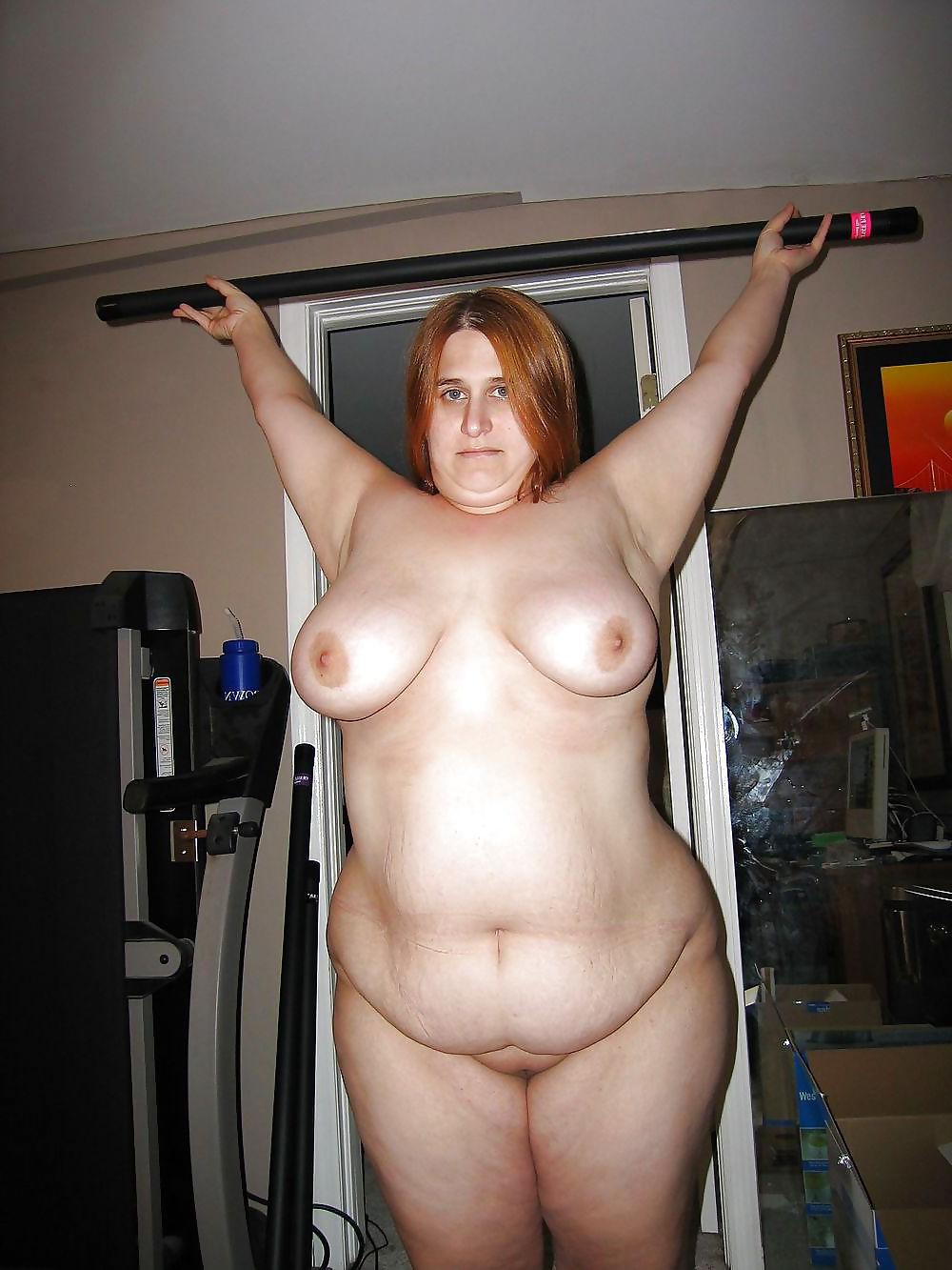 25P Stretch Marks, Scars and Saggy 25