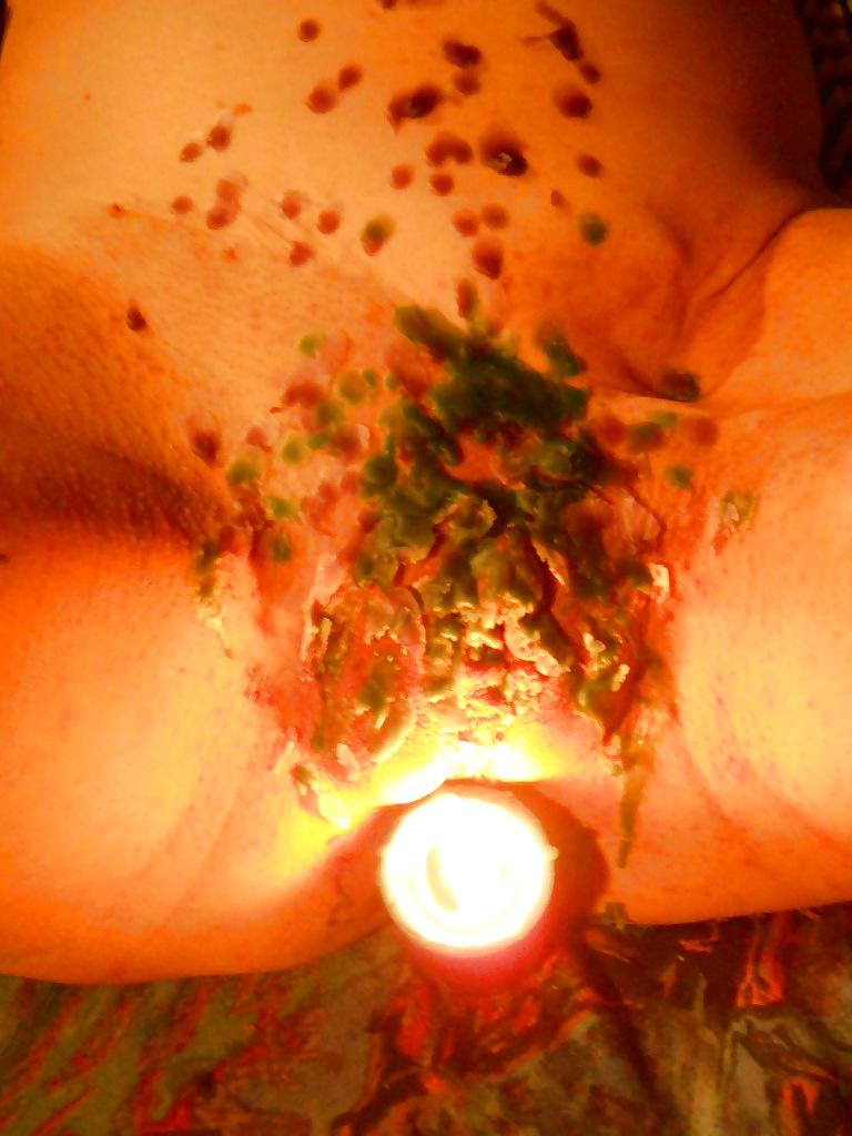 7P Hot wax