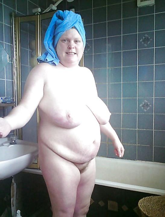 24P Stretch Marks, Scars and Saggy  4