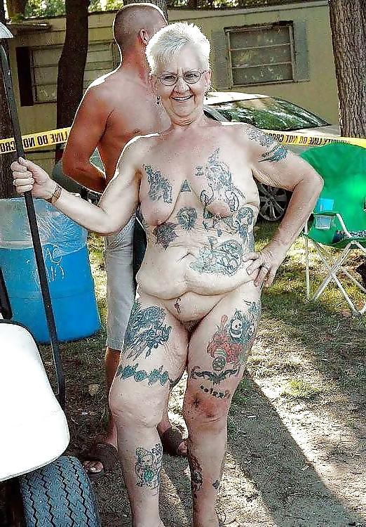 24P Stretch Marks, Scars and Saggy 6