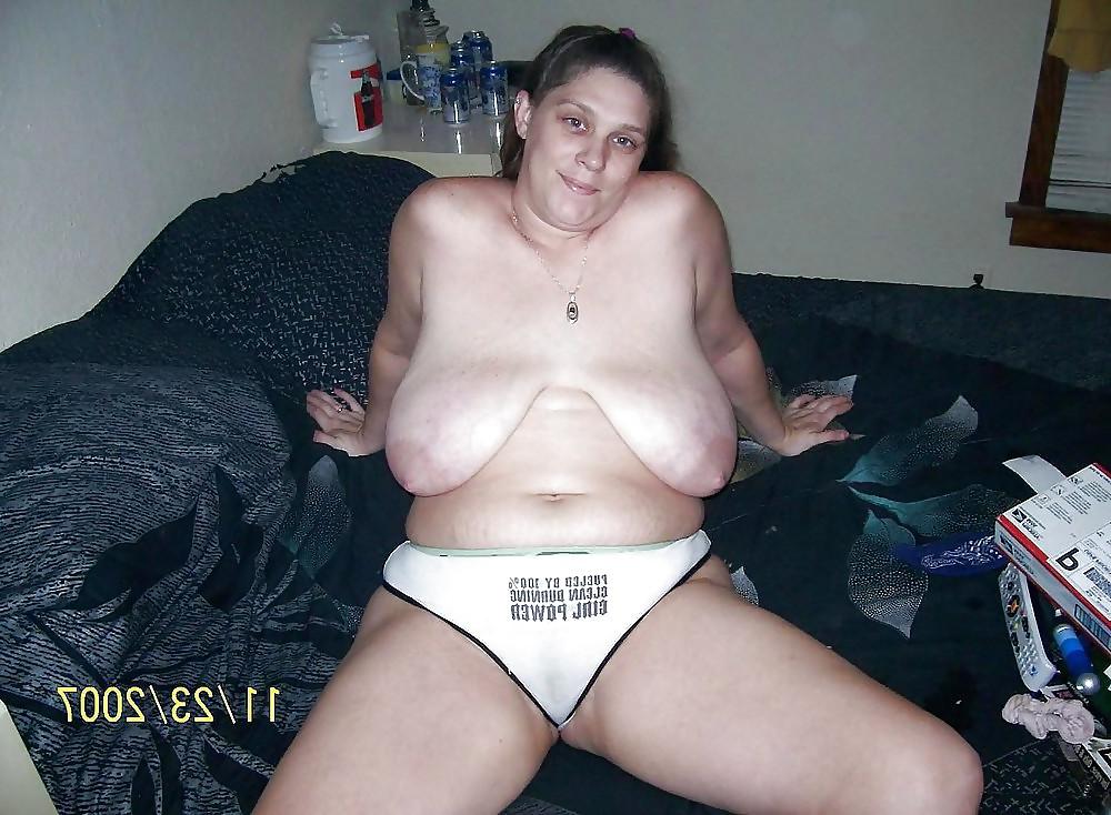25P Stretch Marks, Scars and Saggy 19
