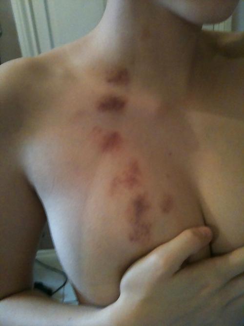 25P Asses  Hairy Babes top