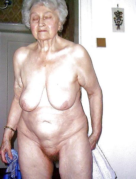 25P Stretch Marks, Scars and Saggy 23