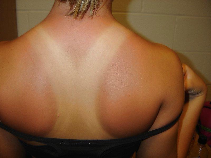 22P Line Sun burnt Girls