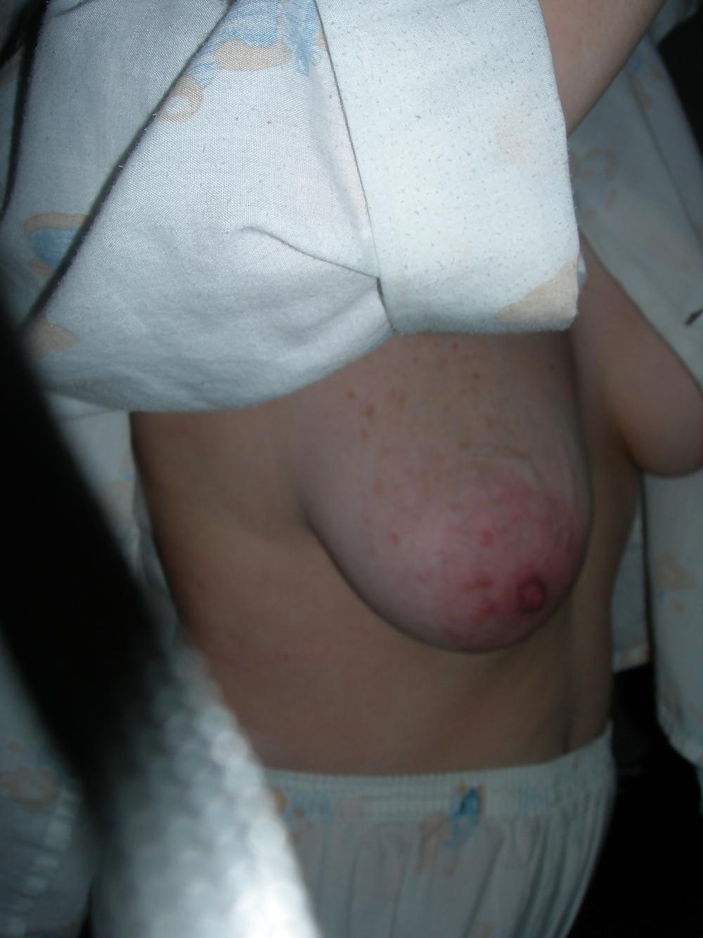 7P Saggy tits