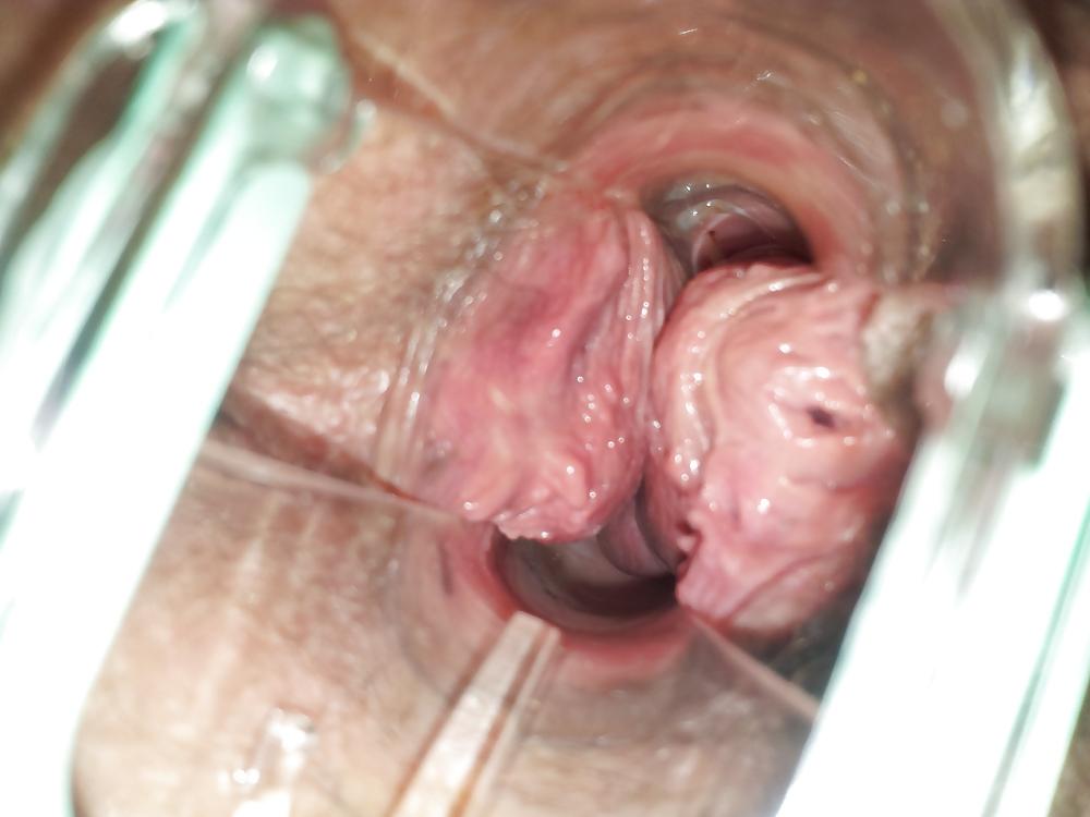 17P Wifes at home gyno exam