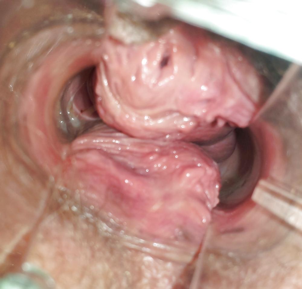17P Wifes at home gyno exam