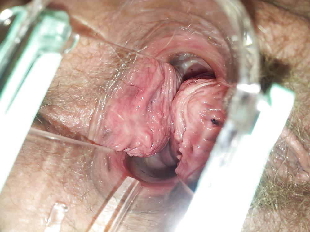 17P Wifes at home gyno exam