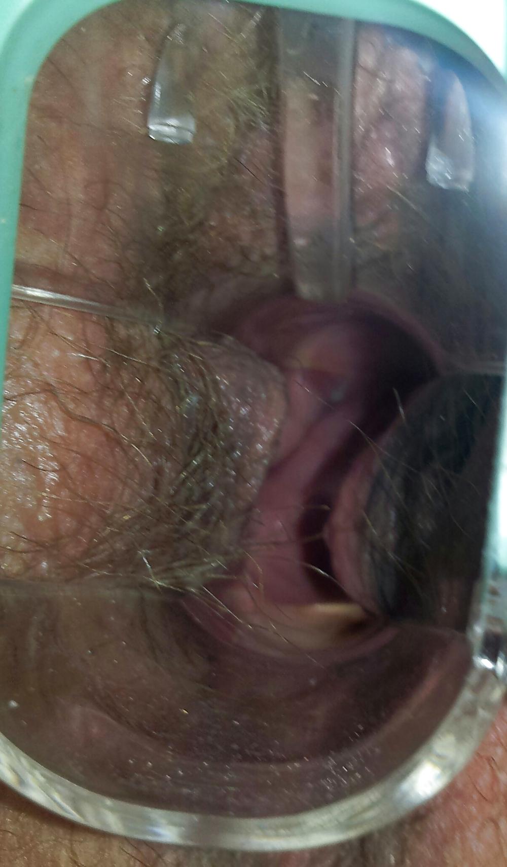 17P Wifes at home gyno exam