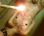 7P Hot wax