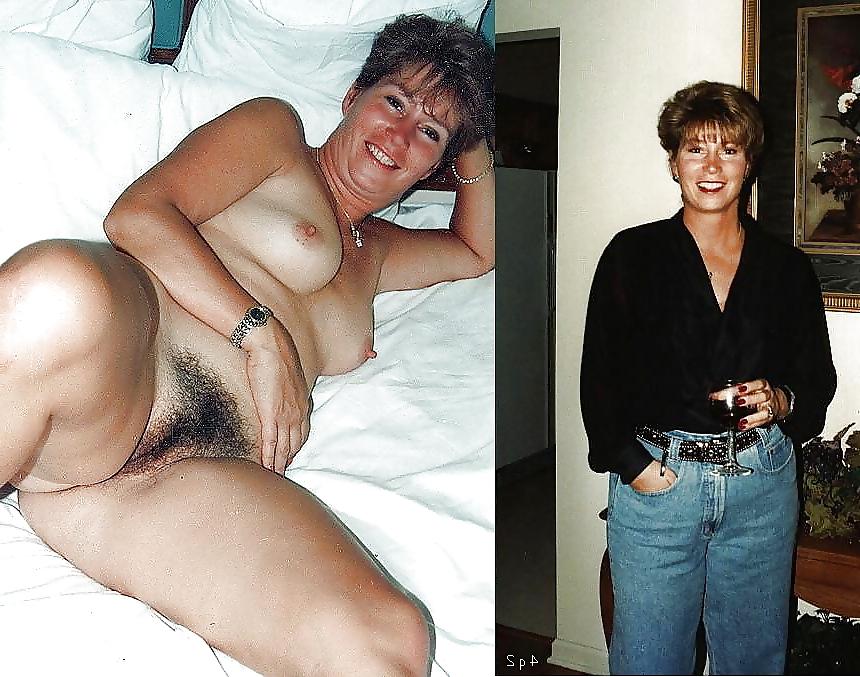 25P Dressed - Undressed Hairy Women