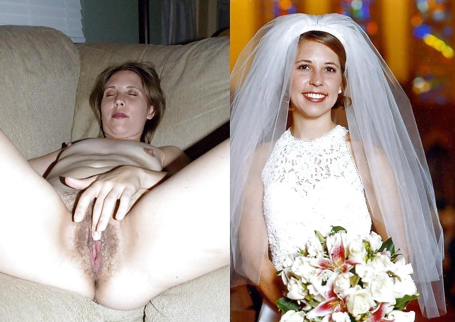 25P Dressed - Undressed Hairy Women