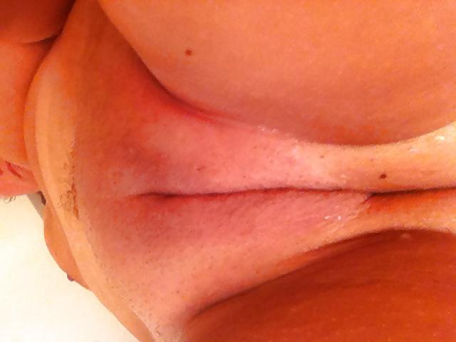 10P Gyno's dream