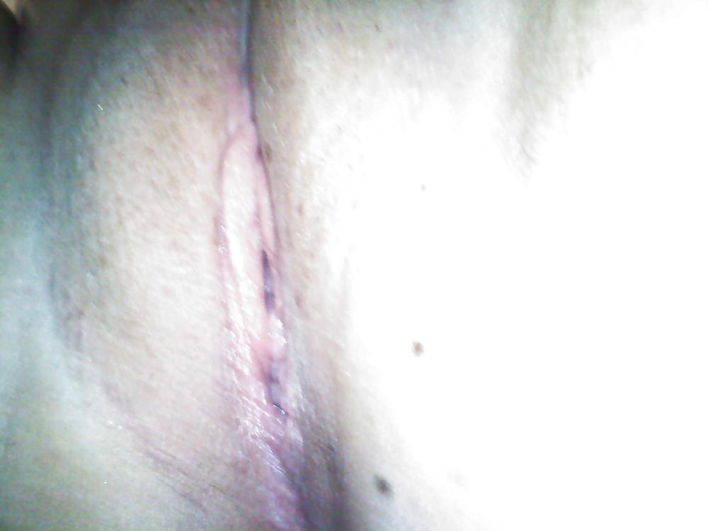 10P Gyno's dream