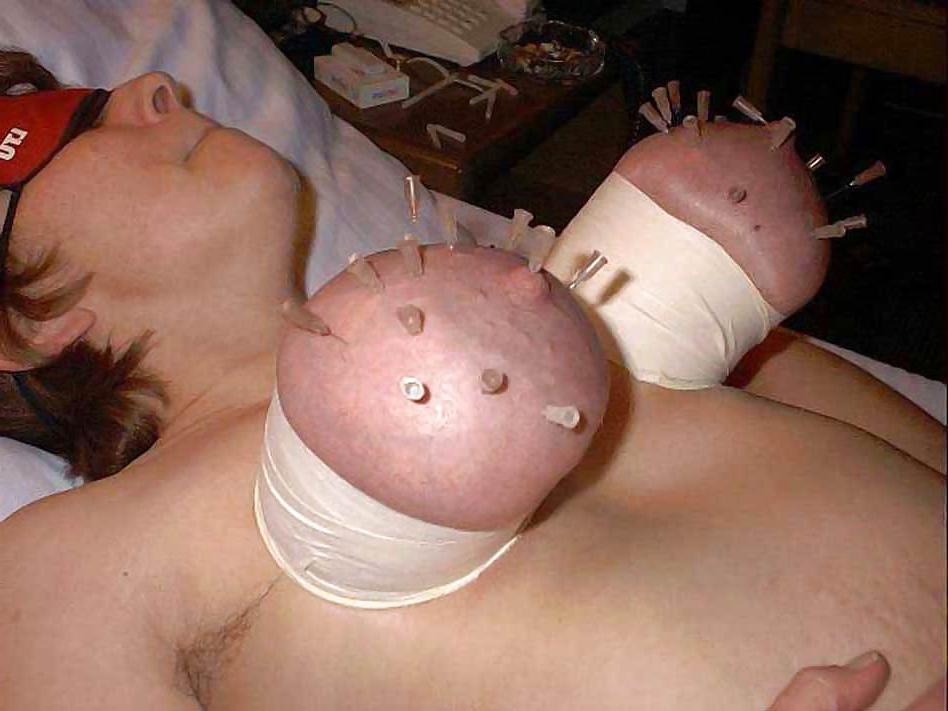 25P Mix of Torture and other Pain