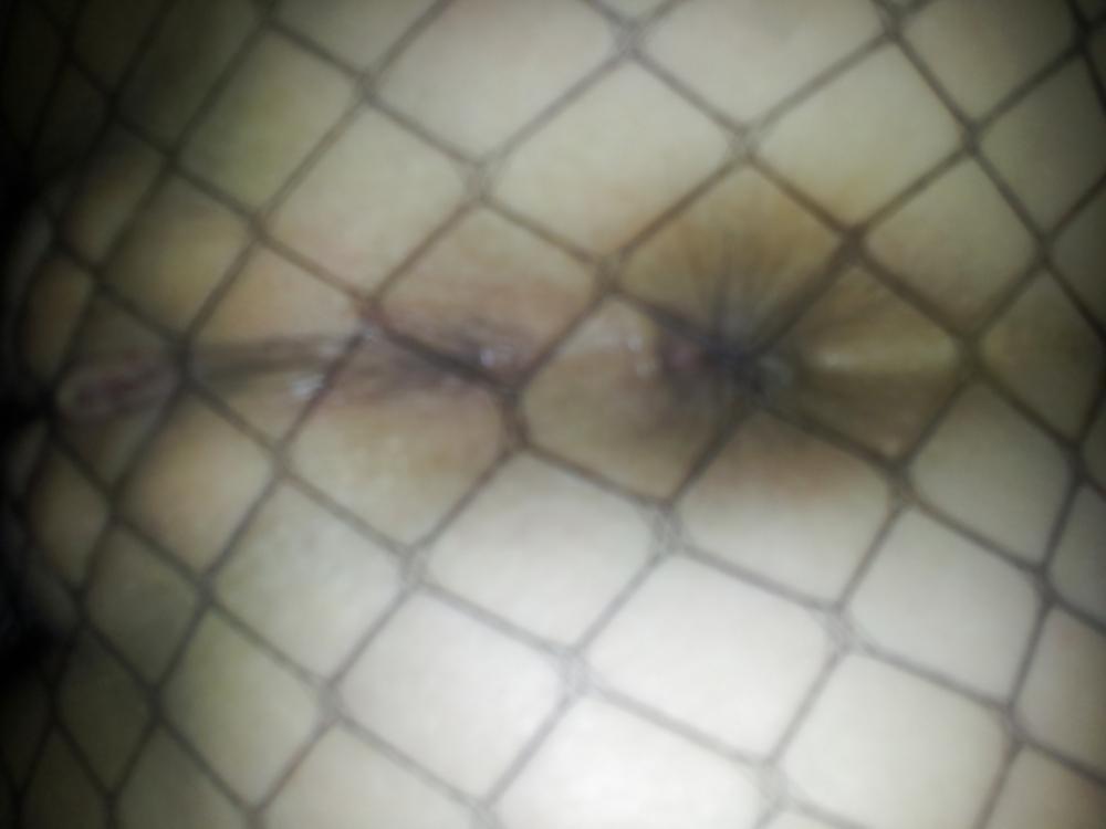 22P Fishnet fun x