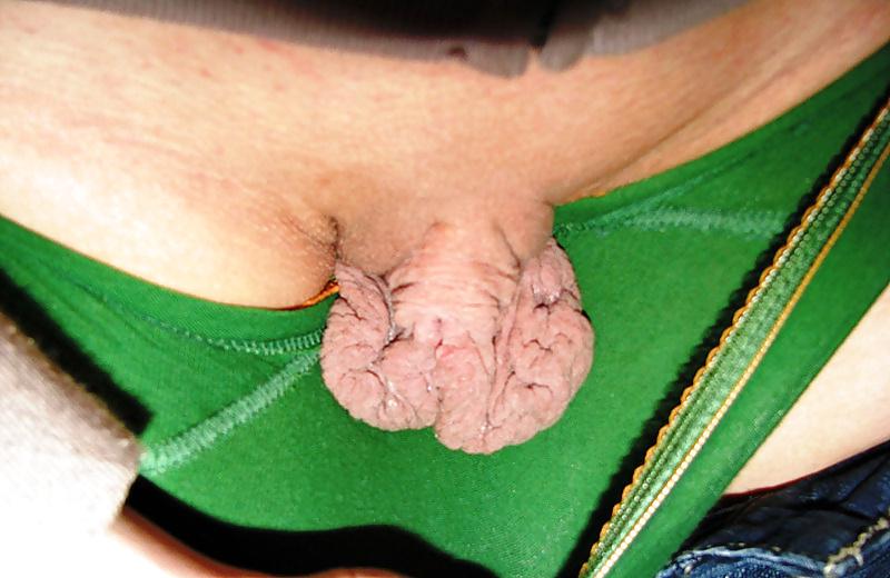 25P First Class Labia Lips