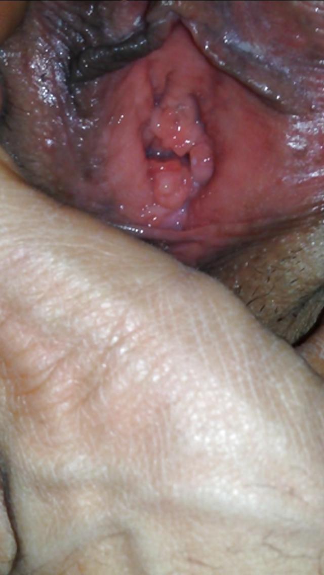 25P Zoom Pussy Zoom Ass - Suck or Fuck ??