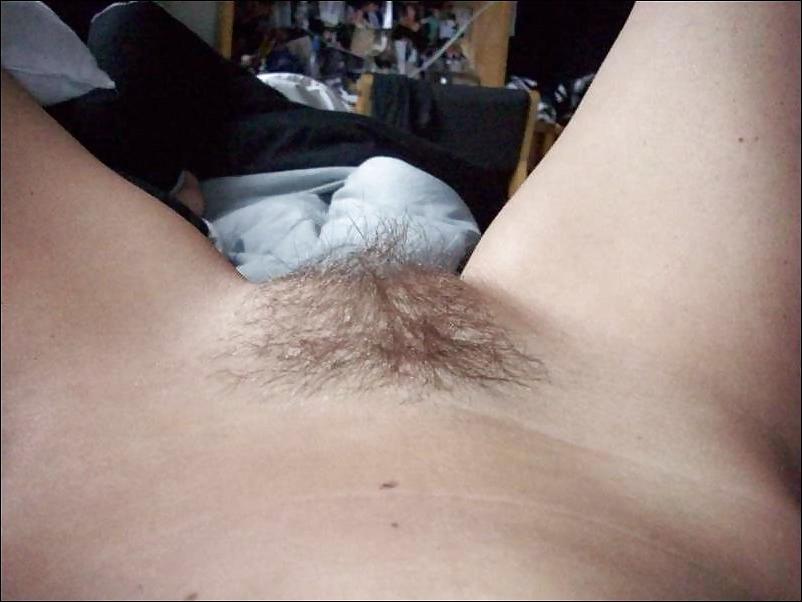 25P Hairy teen girls