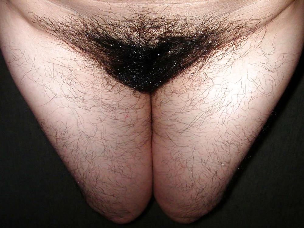 25P Hairy women 20
