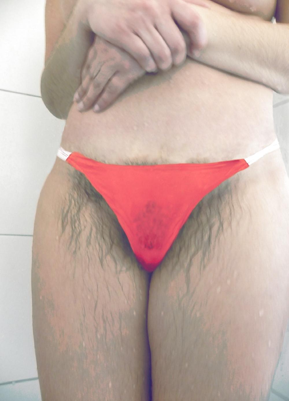 25P Hairy hairy hairy 