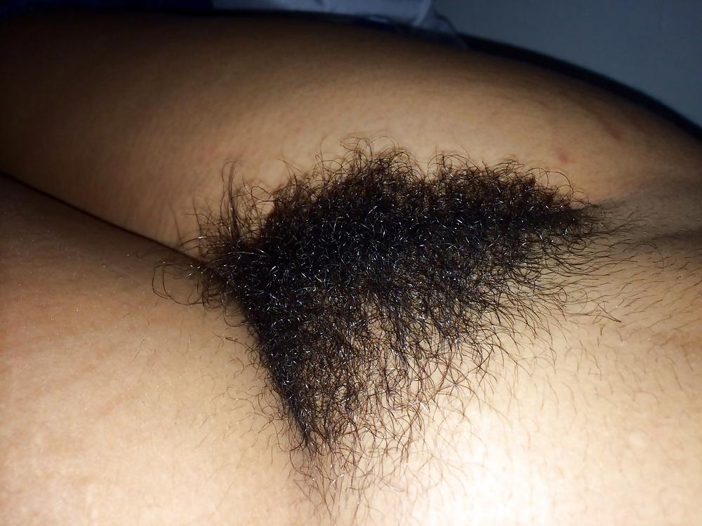 25P Hairy hairy hairy 
