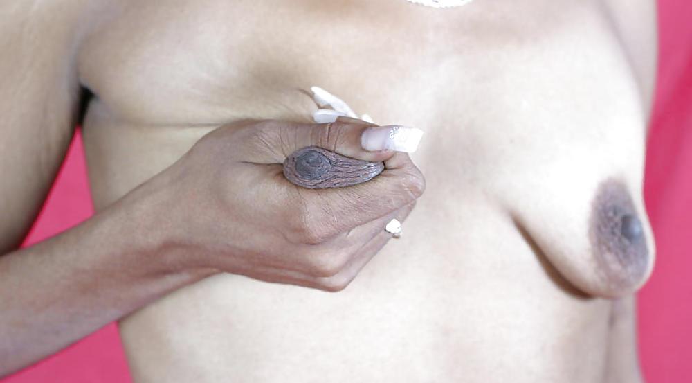 25P Deformed and saggy titts
